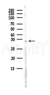 WBSCR22 Antibody - Western blot analysis of lysates from COLO205 cells(heat-shock,45min treatment), using WBSCR22 Antibody at 1/1000 dilution.