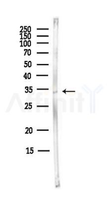 WBSCR22 Antibody - Western blot analysis of lysates from MCF7 cells(heat-shock,45min treatment), using WBSCR22 Antibody at 1/1000 dilution.