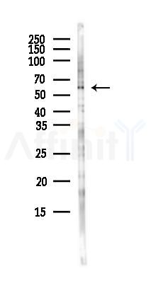 CPNE3 Antibody - Western blot analysis of lysates from COLO205 cells(heat-shock,45min treatment), using CPNE3 Antibody at 1/1000 dilution.