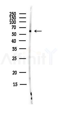 CPNE3 Antibody - Western blot analysis of lysates from MCF7 cells(heat-shock,45min treatment), using CPNE3 Antibody at 1/1000 dilution.