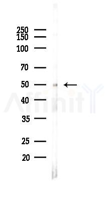 IRX5 Antibody - Western blot analysis of lysates from PC12 cells, using IRX5 Antibody at 1/1000 dilution.