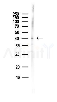 RAD51AP1 Antibody - Western blot analysis of lysates from MCF7 cells(heat-shock,45min treatment), using RAD51AP1 Antibody at 1/1000 dilution.