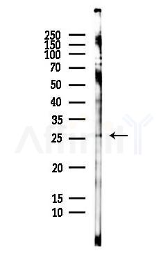SLD5 Antibody - Western blot analysis of lysates from HepG2 cells(LPS,4h treatment), using SLD5 Antibody at 1/1000 dilution.