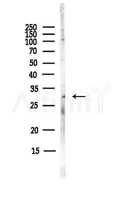 ITM2C Antibody - Western blot analysis of lysates from MCF7 cells(heat-shock,45min treatment), using ITM2C Antibody at 1/1000 dilution.