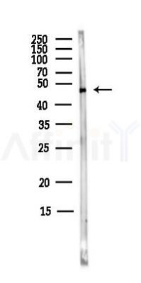 Sohlh2 Antibody - Western blot analysis of lysates from MCF7 cells(heat-shock,45min treatment), using Sohlh2 Antibody at 1/1000 dilution.