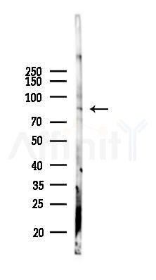 C2CD2 Antibody - Western blot analysis of lysates from Mouse liver, using C2CD2 Antibody at 1/1000 dilution.