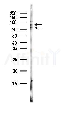C2CD2 Antibody - Western blot analysis of lysates from COLO205 cells(heat-shock,45min treatment), using C2CD2 Antibody at 1/1000 dilution.