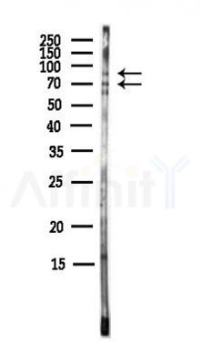 C2CD2 Antibody - Western blot analysis of lysates from MCF7 cells(heat-shock,45min treatment), using C2CD2 Antibody at 1/1000 dilution.