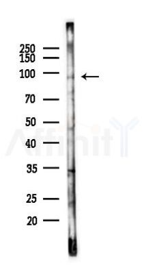 C2CD2 Antibody - Western blot analysis of lysates from PC12 cells, using C2CD2 Antibody at 1/1000 dilution.