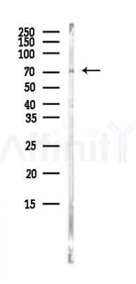 STAU2 Antibody - Western blot analysis of lysates from COLO205 cells(heat-shock,45min treatment), using STAU2 Antibody at 1/1000 dilution.