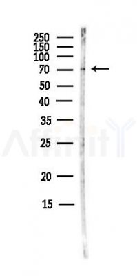 STAU2 Antibody - Western blot analysis of lysates from MCF7 cells(heat-shock,45min treatment), using STAU2 Antibody at 1/1000 dilution.