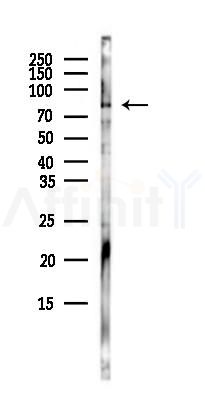 TARS Antibody - Western blot analysis of lysates from COLO205 cells(heat-shock,45min treatment), using TARS Antibody at 1/1000 dilution.