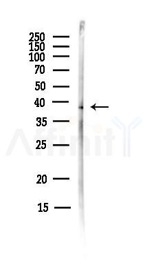 Mitoferrin1 Antibody - Western blot analysis of lysates from MCF7 cells(heat-shock,45min treatment), using Mitoferrin1 Antibody at 1/1000 dilution.