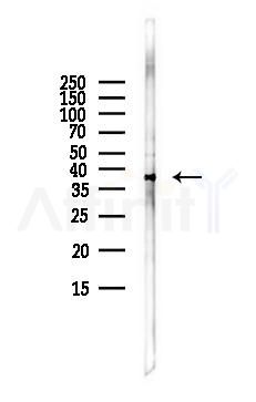 PRELP Antibody - Western blot analysis of lysates from LoVo cells(heat-shock,45min treatment), using PRELP Antibody at 1/1000 dilution.