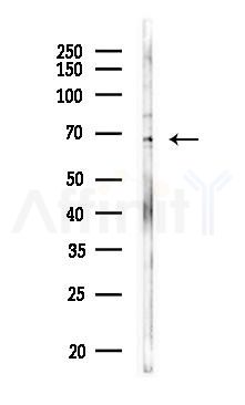 STXBP2 Antibody - Western blot analysis of lysates from COLO205 cells, using STXBP2 Antibody at 1/1000 dilution.