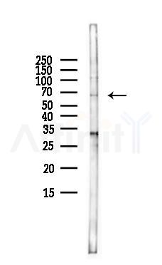 SLC47A1 Antibody - Western blot analysis of lysates from LoVo cells(heat-shock,45min treatment), using SLC47A1 Antibody at 1/1000 dilution.