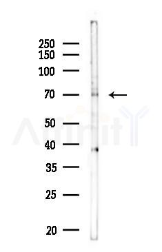 KLHL24 Antibody - Western blot analysis of lysates from COLO205 cells, using KLHL24 Antibody at 1/1000 dilution.