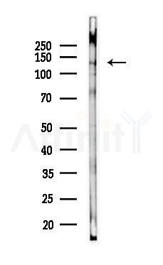 alpha COP I Antibody - Western blot analysis of lysates from COLO205 cells, using alpha COP I Antibody at 1/1000 dilution.