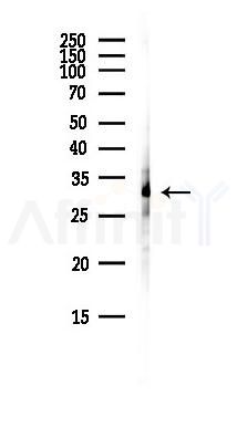 CCDC106 Antibody - Western blot analysis of lysates from RAW264.