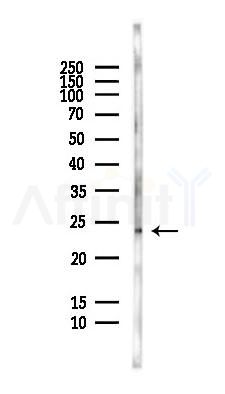 PLAC1 Antibody - Western blot analysis of lysates from HepG2 cells(LPS,4h treatment), using PLAC1 Antibody at 1/1000 dilution.