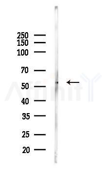 MFSD2A Antibody - Western blot analysis of lysates from PC12 cells, using MFSD2A Antibody at 1/1000 dilution.