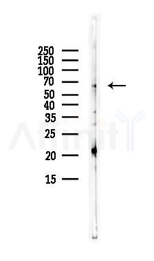 SEPN1 Antibody - Western blot analysis of lysates from LoVo cells(heat-shock,45min treatment), using SEPN1 Antibody at 1/1000 dilution.
