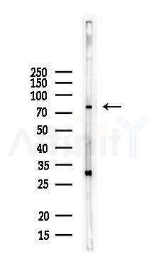 LRFN5 Antibody - Western blot analysis of lysates from Mouse brain, using LRFN5 Antibody at 1/1000 dilution.