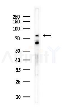 LRFN5 Antibody - Western blot analysis of lysates from COLO205 cells, using LRFN5 Antibody at 1/1000 dilution.