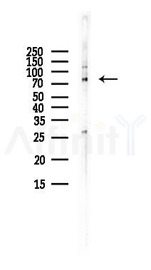 LRFN5 Antibody - Western blot analysis of lysates from LoVo cells(heat-shock,45min treatment), using LRFN5 Antibody at 1/1000 dilution.