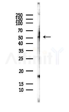 MATN3 Antibody - Western blot analysis of lysates from HepG2 cells(LPS,4h treatment), using MATN3 Antibody at 1/1000 dilution.