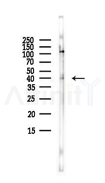 HOXA13 Antibody - Western blot analysis of lysates from LoVo cells(heat-shock,45min treatment), using HOXA13 Antibody at 1/1000 dilution.