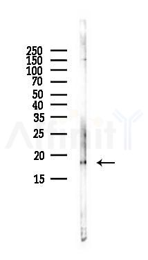 ORMDL3 Antibody - Western blot analysis of lysates from LoVo cells(heat-shock,45min treatment), using ORMDL3 Antibody at 1/1000 dilution.