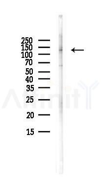 TTF2 Antibody - Western blot analysis of lysates from LoVo cells(heat-shock,45min treatment), using TTF2 Antibody at 1/1000 dilution.