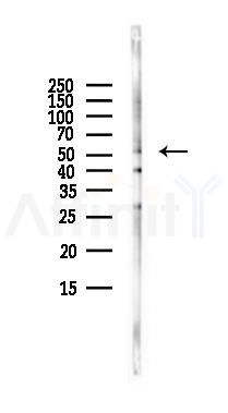 ALDH3A2 Antibody - Western blot analysis of lysates from LoVo cells(heat-shock,45min treatment), using ALDH3A2 Antibody at 1/1000 dilution.