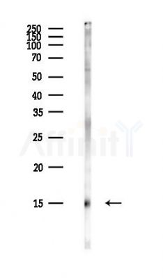 DDT Antibody - Western blot analysis of lysates from COLO205 cells(heat-shock,45min treatment), using DDT Antibody at 1/1000 dilution.