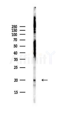 VKORC1L1 Antibody - Western blot analysis of lysates from Hela cells(UV,30min treatment), using VKORC1L1 Antibody at 1/1000 dilution.