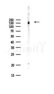 PREX2 Antibody - Western blot analysis of lysates from Hela cells(UV,30min treatment), using PREX2 Antibody at 1/1000 dilution.