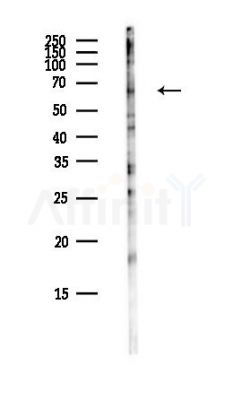 PLBD2 Antibody - Western blot analysis of lysates from COLO205 cells(heat-shock,45min treatment), using PLBD2 Antibody at 1/1000 dilution.