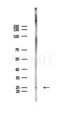 HSCB Antibody - Western blot analysis of lysates from PC12 cells, using HSCB Antibody at 1/1000 dilution.