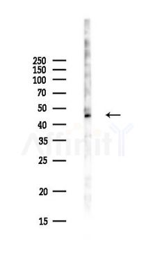 SMAP2 Antibody - Western blot analysis of lysates from Hela cells(UV,30min treatment), using SMAP2 Antibody at 1/1000 dilution.