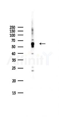 C1orf114 Antibody - Western blot analysis of lysates from Hela cells(UV,30min treatment), using C1orf114 Antibody at 1/1000 dilution.