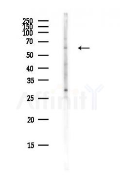 C1orf114 Antibody - Western blot analysis of lysates from COLO205 cells(heat-shock,45min treatment), using C1orf114 Antibody at 1/1000 dilution.