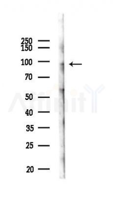 L1TD1 Antibody - Western blot analysis of lysates from HepG2 cells(heat-shock,45min treatment), using L1TD1 Antibody at 1/1000 dilution.