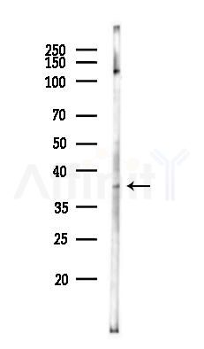 LRRC67 Antibody - Western blot analysis of lysates from A375 cells(heat-shock,45min treatment), using LRRC67 Antibody at 1/1000 dilution.