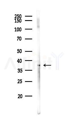 LRRC67 Antibody - Western blot analysis of lysates from HepG2 cells(heat-shock,45min treatment), using LRRC67 Antibody at 1/1000 dilution.