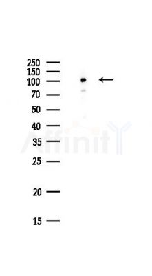 CLSTN2 Antibody - Western blot analysis of lysates from Hela cells(UV,30min treatment), using CLSTN2 Antibody at 1/1000 dilution.