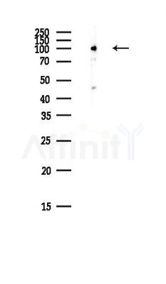 CLSTN2 Antibody - Western blot analysis of lysates from COLO205 cells(heat-shock,45min treatment), using CLSTN2 Antibody at 1/1000 dilution.