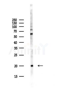 Amelotin Antibody - Western blot analysis of lysates from Hela cells(UV,30min treatment), using Amelotin Antibody at 1/1000 dilution.