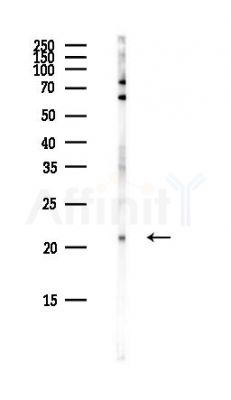 Amelotin Antibody - Western blot analysis of lysates from COLO205 cells(heat-shock,45min treatment), using Amelotin Antibody at 1/1000 dilution.