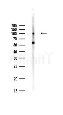 YTHDC1 Antibody - Western blot analysis of lysates from Hela cells(UV,30min treatment), using YTHDC1 Antibody at 1/1000 dilution.